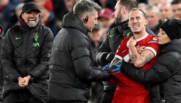 Клоп Ливърпул Арсенал - Шок на 