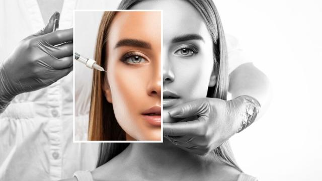 Тенденции сред пластични операции (ГАЛЕРИЯ)