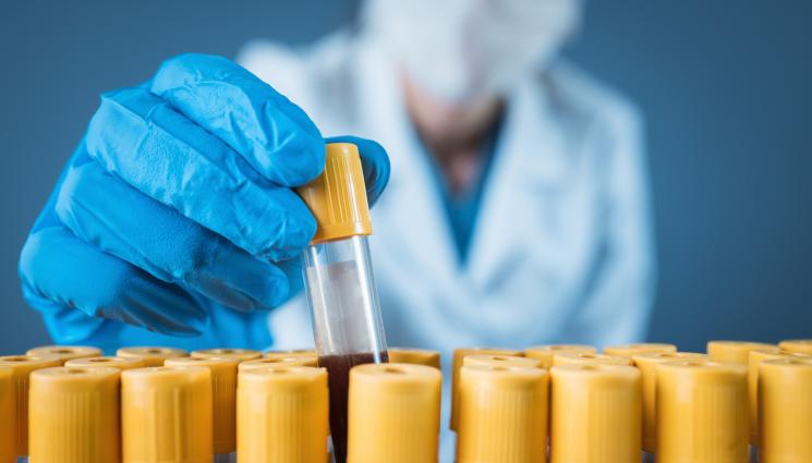 кръв лаборатория - ЗЛАТНО ВРЕМЕ: Кръвен тест определя реалната възраст на органите