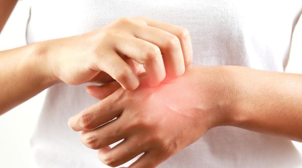 Нежни решения за проблемната кожа