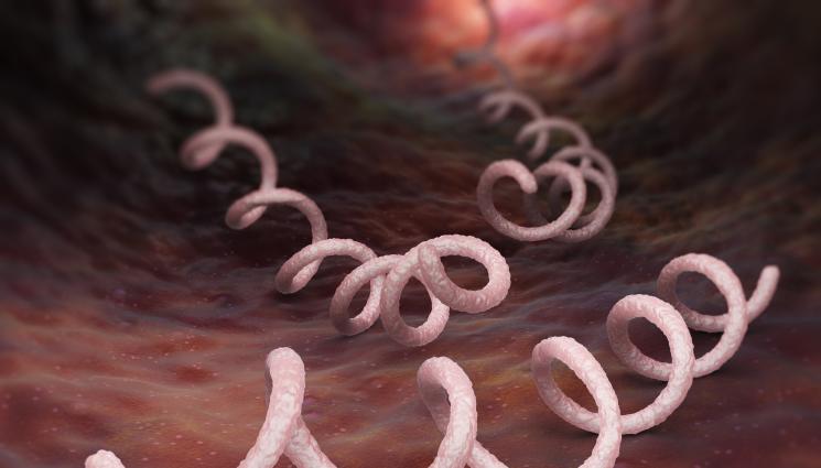 сифилис - ЗАКЪСАХА ГО: Болните от сифилис в САЩ се увеличиха с 80%! 