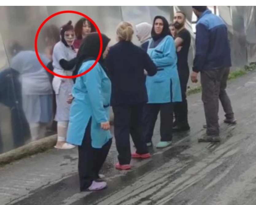 ринопластика