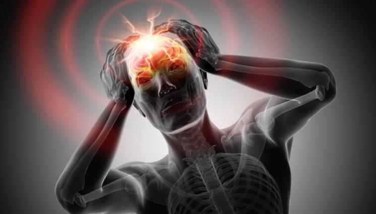 инсулт - ЗЛАТНО ВРЕМЕ: Микроинсултът – бърз гост