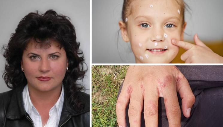 кожни болести - Краста напада забавачките!