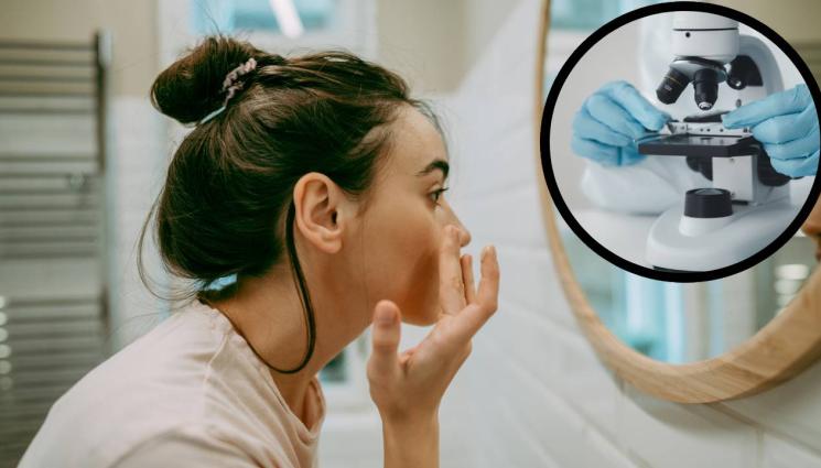 крем - ОПАСНОСТ ДЕБНЕ ОТВСЯКЪДЕ: Кремовете за акне могат да ни докарат рак!