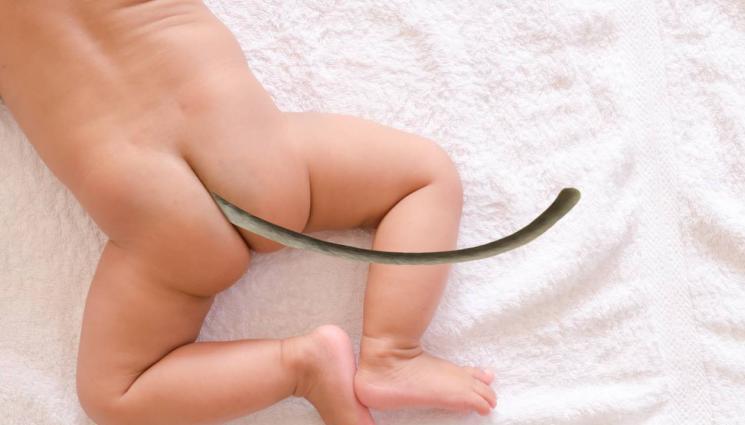 бебе опашка - ИСТИНСКО ЧУДО! Бебе се роди с опашка! (ВИДЕО)