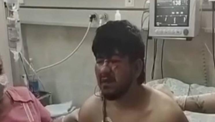 терорист - СЛЕД СТРЕЛБАТА В МОСКВА: Терористът в болницата иска преводач (ВИДЕО)