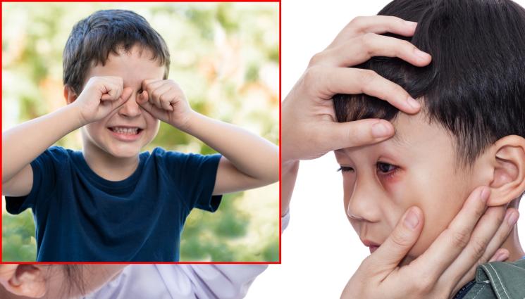 конюнктивит - ЗА УЖАС НА РОДИТЕЛИТЕ: Цели класове с конюнктивит