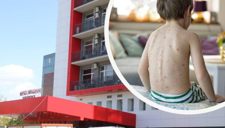 пирогов шарка - В ПИРОГОВ: Лекари спасиха дете със сепсис след варицела