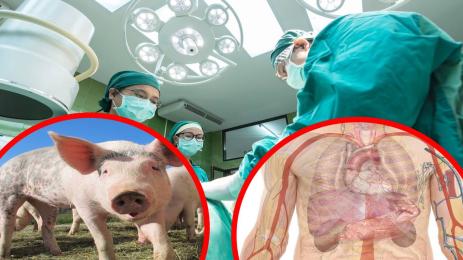 трансплантация