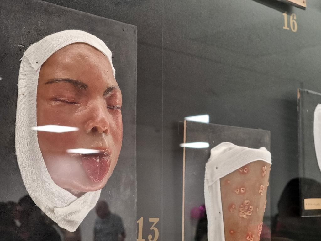 Първата експозиция на новия Музей на медицината История от восък
