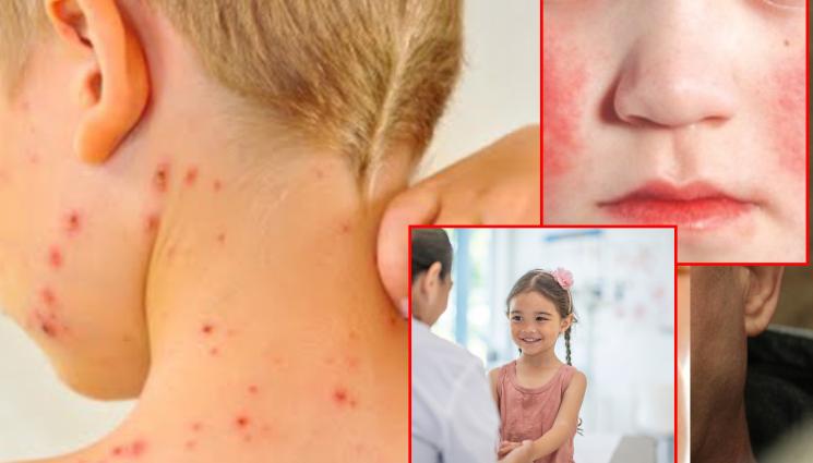 шарка - НЯМАТ КРАЙ: Връхлита ни и болестта на ударения шамар!