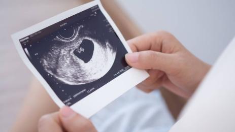 бременност