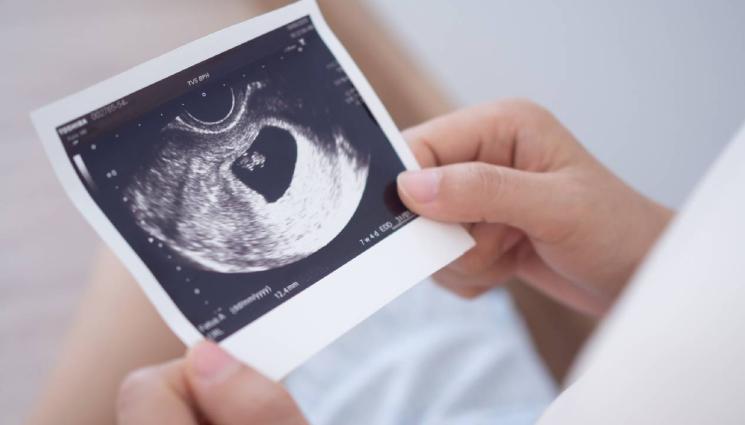 бременност - РАДОСТНА ВЕСТ: Ралица от Игрите чака бебе! (СНИМКА)