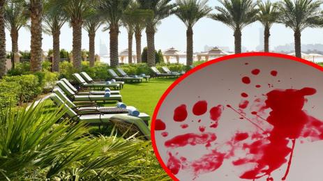 курорт кръв