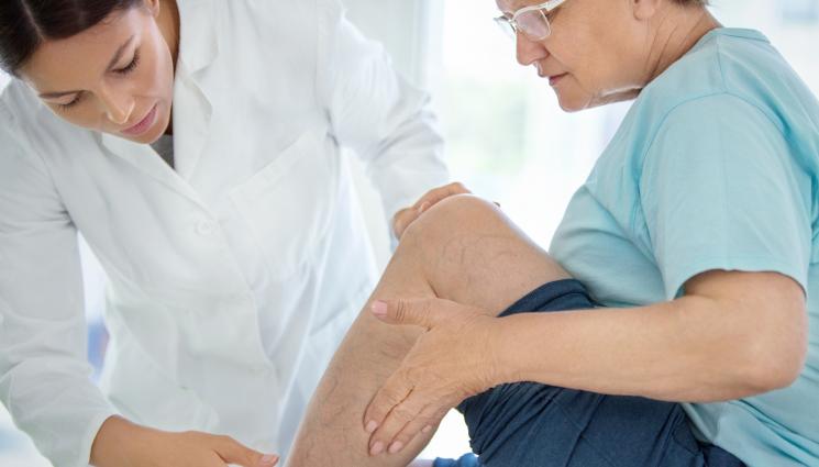 разширени вени - ЗЛАТНО ВРЕМЕ: 7 мита за разширените вени