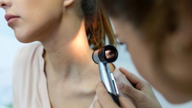 Разработиха нов крем, който помага на имунната система да се бори с рака на кожата