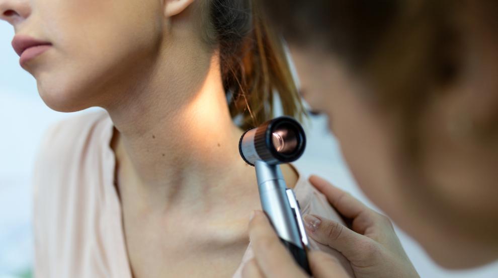 Разработиха нов крем, който помага на имунната система да се бори с рака на кожата