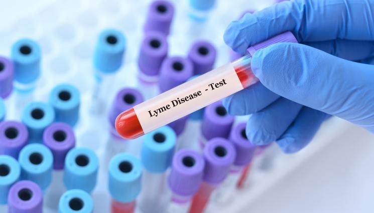 Лаймска болест - ЗА ЕДНА ГОДИНА: 30% скок на заразените с лаймска болест!