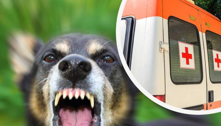 куче линейка - НЕ ПАК, А ОТНОВО: Системно заплашват с убийство и насъскват кучета срещу фелдшер!