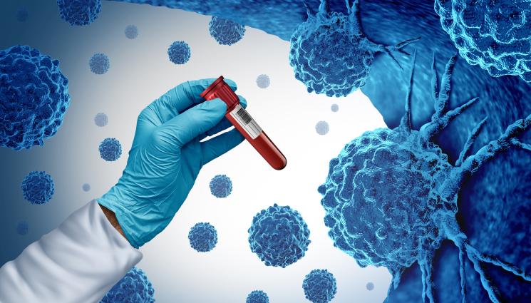 рак - СЗО БИЕ ТРЕВОГА: Европейците бавно, но сигурно умират от рак!