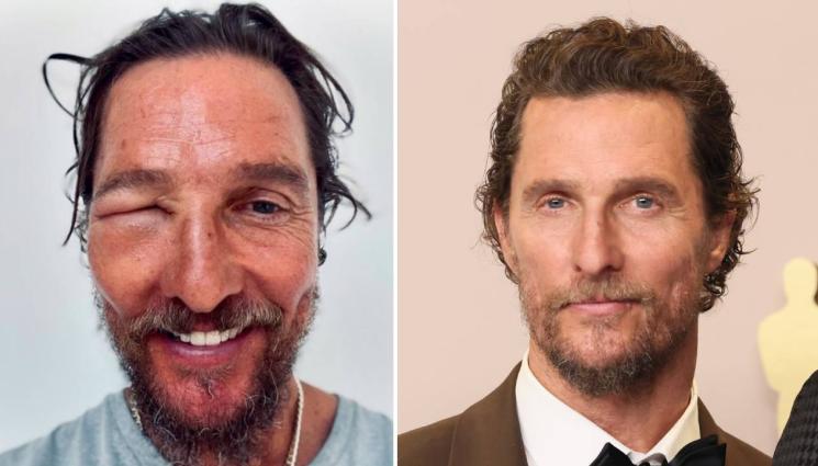 Матю Макконъхи - Защо Матю Макконъхи изглежда така?