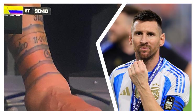 Меси - КОШМАРНА ГЛЕДКА: Вижте как изглежда глезенът на Меси (ВИДЕО)