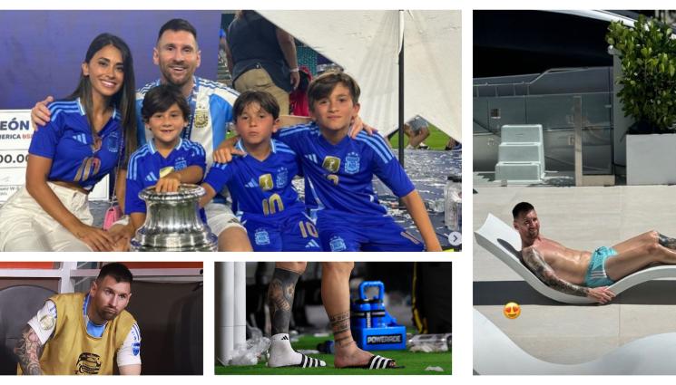 Лионел Меси - Меси се отдаде на почивка, лекува контузения си глезен край басейна