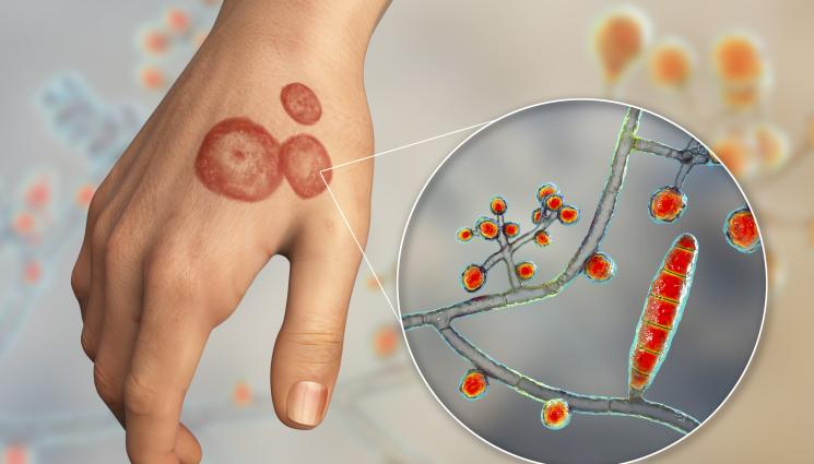 гъбички - ЗЛАТНО ВРЕМЕ: 300 вида гъбички ни атакуват през лятото