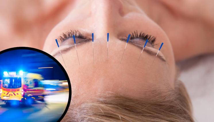 с - НЕ ОСТАНА ЗДРАВО МЯСТО: Приеха по спешност жена със 77 игли в главата!