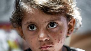 Постоянен поток от нещастни деца и разтревожени родители се вливат