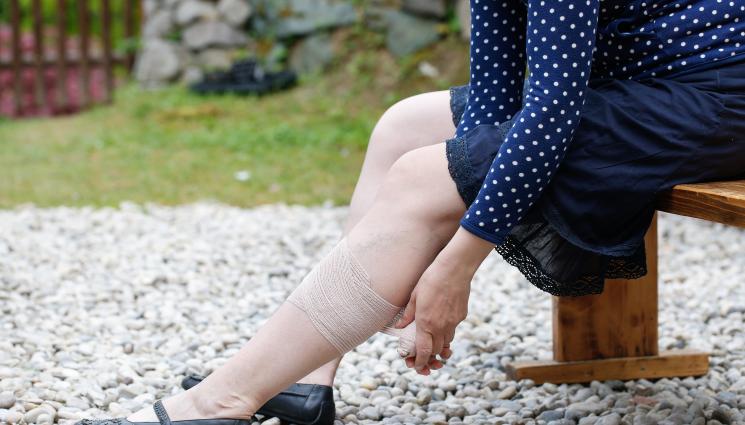 разширени вени - ЗЛАТНО ВРЕМЕ: Хрупаме чесън и джинджифил при разширени вени