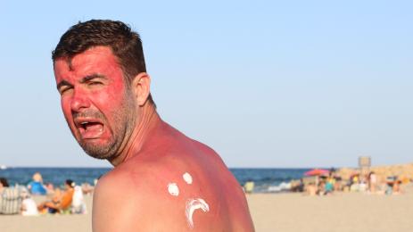 крем слънце