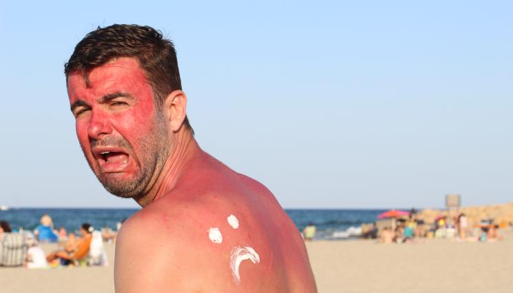 крем слънце - ПРАКТИЧНИ СЪВЕТИ: Защо е задължително да се плескаме с крем