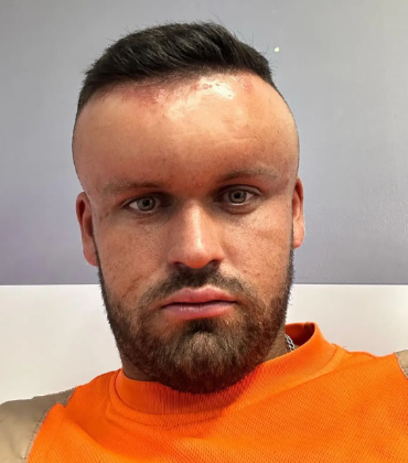 боя за коса