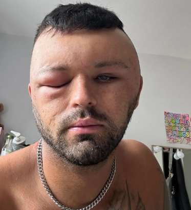 боя за коса