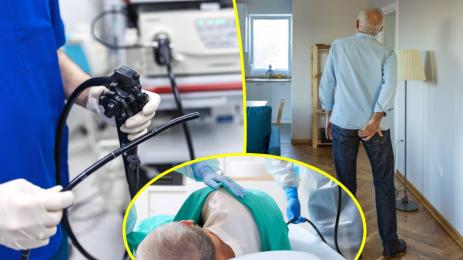 колоноскопия