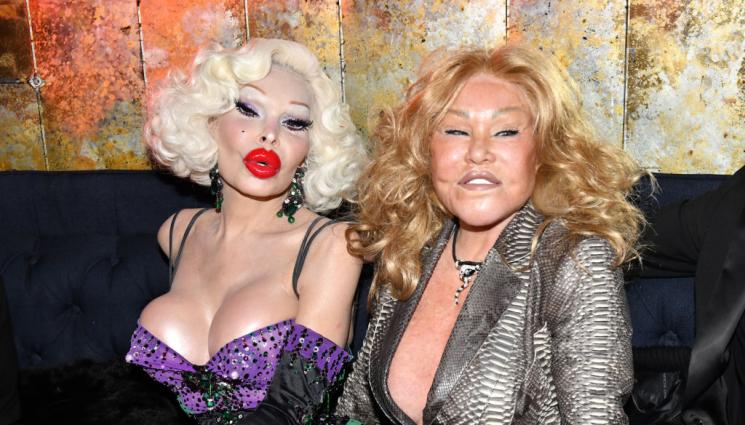 Джоселин Уилденщайн жената котка - Жената-котка показа как е изглеждала преди да се обезобрази (СНИМКА)