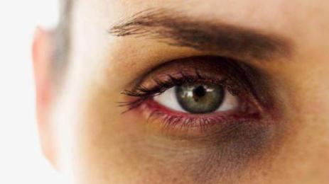 насинено око