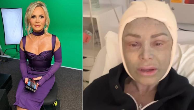 Тамра Джъдж - ГАДОСТ: Това е резултатът от лазерна терапия на холивудска актриса (ВИДЕО)