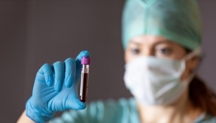 кръвна група - РАЗРЕШИХА 50-ГОДИШНА ЗАГАДКА: Учени откриха нова кръвна група!