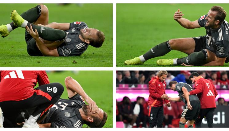 Хари Кейн Байерн контузия - Байерн увърта за състоянието на Хари Кейн, успокоява феновете с кух оптимизъм