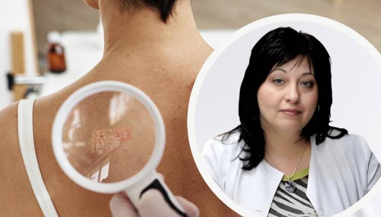 акне - Прибираме се от море с акне „Майорка“!