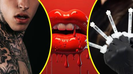 устни инжекции