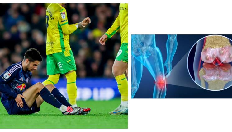 Илия Груев контузия операция - Груев по-зле от очакваното. Националът ляга под ножа, ще е аут до Нова година