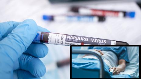 Марбургска треска вирус Марбург