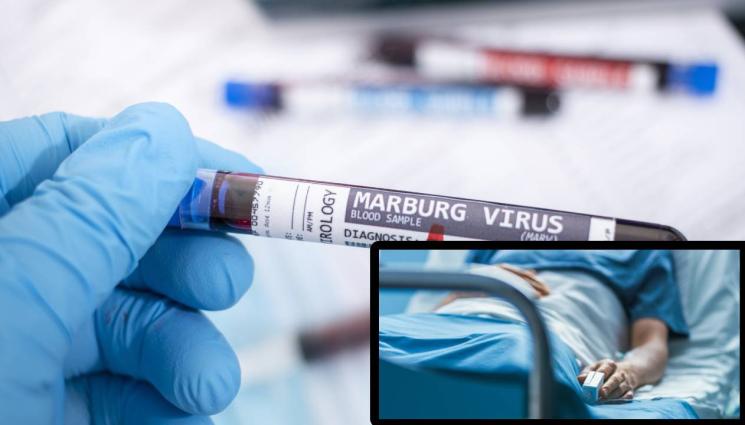 Марбургска треска вирус Марбург