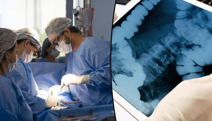 dd - Дете почина, след като лекари извадиха 65 предмета от стомаха му!