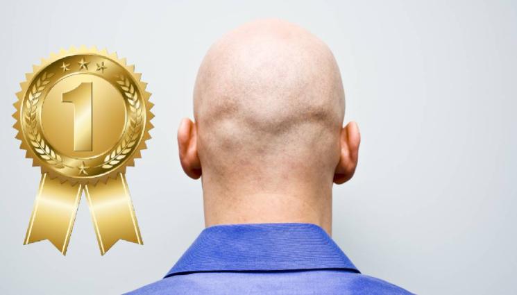 дд - Ето кой избраха за най-сексапилен плешив мъж за 2024-та! (СНИМКИ)