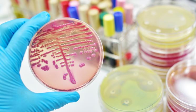 гъбички - СЗО АЛАРМИРА: Вид гъбична инфекция се оказа заплаха за човечеството!